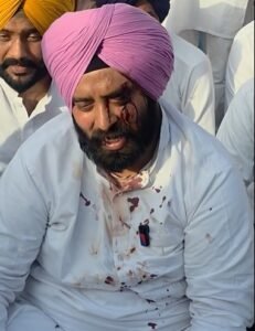 ਤਲਵੰਡੀ ਭਾਈ, ਵੜਿੰਗ, ਜ਼ੀਰਾ ਵਿੱਚ ਕਾਂਗਰਸੀ ਆਗੂਆਂ 'ਤੇ ਹੋਏ ਕਥਿਤ ਹਮਲੇ ਤੋਂ ਬਾਅਦ 300+ ਲੋਕਾਂ ਵਿਰੁੱਧ ਐਫਆਈਆਰ ਦਰਜ ਸਖ਼ਤ ਕਾਰਵਾਈ ਦੀ ਮੰਗ